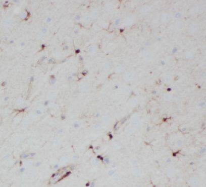 Immunohistochemistry: HES5 Antibody - BSA Free [NBP3-46125] - Immunohistochemistry of paraffin-embedded mouse brain tissue slide using (HES5 Antibody) at dilution of 1:50