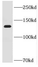 Western Blot DNA helicase B Antibody - BSA Free