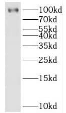 Western Blot: HECTD3 Antibody - BSA Free [NBP3-46132] - MCF-7 cells were subjected to SDS PAGE followed by western blot with (HECTD3 antibody) at dilution of 1:2000