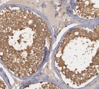 Immunohistochemistry: HEATR4 Antibody - BSA Free [NBP3-46135] - Immunohistochemistry of paraffin-embedded human testis tissue slide using ( HEATR4 Antibody) at dilution of 1:50