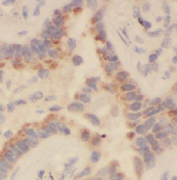 Immunohistochemistry: HEATR2 Antibody - BSA Free [NBP3-46136] - Immunohistochemistry of paraffin-embedded human kidney tissue slide using (HEATR2 Antibody) at dilution of 1:50