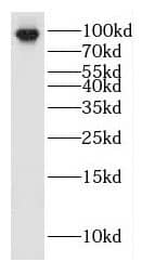 Western Blot HEATR2 Antibody - BSA Free