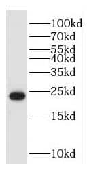 Western Blot HDDC3 Antibody - BSA Free
