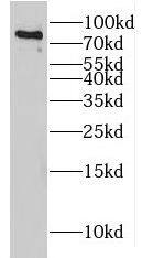 Western Blot Host cell factor C2 Antibody - BSA Free