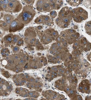 Immunohistochemistry HBXIP Antibody - BSA Free