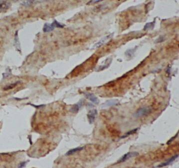 Immunohistochemistry: Hemoglobin delta Antibody - BSA Free [NBP3-46147] - Immunohistochemistry of paraffin-embedded rat heart using (Hemoglobin delta antibody) at dilution of 1:100