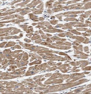 Immunohistochemistry: GUCY2F Antibody - BSA Free [NBP3-46155] - Immunohistochemistry of paraffin-embedded human heart tissue slide using (GUCY2F Antibody) at dilution of 1:50