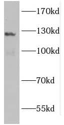 Western Blot: GUCY2F Antibody - BSA Free [NBP3-46155] - Mouse heart tissue were subjected to SDS PAGE followed by western blot with (GUCY2F Antibody) at dilution of 1:600