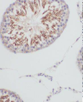 Immunohistochemistry GTPBP5 Antibody - BSA Free