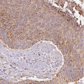 Immunohistochemistry GSTM4 Antibody - BSA Free