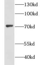 Western Blot GSTCD Antibody - BSA Free