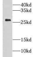 Western Blot: GOSR1 Antibody - BSA Free [NBP3-46171] - Human liver tissue were subjected to SDS PAGE followed by western blot with (GOSR1 antibody) at dilution of 1:500