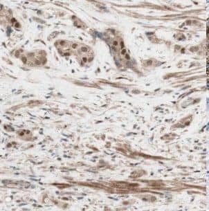 Immunohistochemistry GRWD1 Antibody - BSA Free
