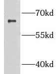 Western Blot GRB 14 Antibody - BSA Free