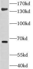 Western Blot GRAMD4 Antibody - BSA Free