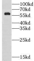 Western Blot: GPT2 Antibody - BSA Free [NBP3-46179] - Mouse kidney tissue were subjected to SDS PAGE followed by western blot with (GPT2 Antibody) at dilution of 1:600