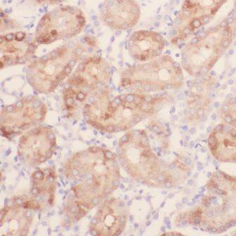 Immunohistochemistry: GPT2 Antibody - BSA Free [NBP3-46179] - Immunohistochemistry of paraffin-embedded human kidney using (GPT2 antibody) at dilution of 1:100