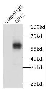 Immunoprecipitation: GPT2 Antibody - BSA Free [NBP3-46179] - IP Result of anti-GPT2 (IP:, 4ug; Detection: 1:500) with mouse kidney tissue lysate 7200ug.