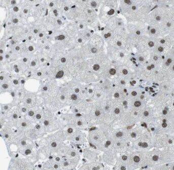 Immunohistochemistry: GPS2 Antibody - BSA Free [NBP3-46181] - Immunohistochemistry of paraffin-embedded human liver tissue slide using (GPS2 Antibody) at dilution of 1:50