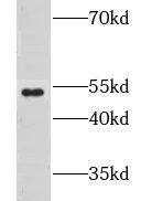 Western Blot: GPR142 Antibody - BSA Free [NBP3-46189] - SH-SY5Y cells were subjected to SDS PAGE followed by western blot with (GPR142 antibody) at dilution of 1:500
