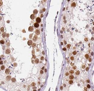 Immunohistochemistry GPR123 Antibody - BSA Free