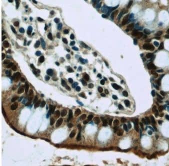 Immunohistochemistry: GPBP Antibody - BSA Free [NBP3-46196] - Immunohistochemistry of paraffin-embedded human small intestine slide using (GPBP Antibody) at dilution of 1:50