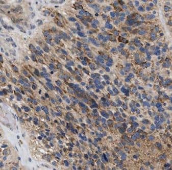 Immunohistochemistry GPAA1 Antibody - BSA Free