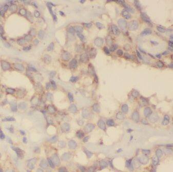 Immunohistochemistry GNPDA2 Antibody - BSA Free