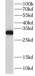 Western Blot: GNPDA2 Antibody - BSA Free [NBP3-46200] - Rat kidney tissue were subjected to SDS PAGE followed by western blot with (GNPDA2 Antibody) at dilution of 1:600