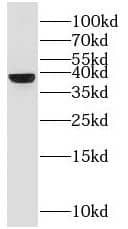 Western Blot: G protein beta 4 Antibody - BSA Free [NBP3-46208] - Human brain tissue were subjected to SDS PAGE followed by western blot with (G protein beta 4 antibody) at dilution of 1:500