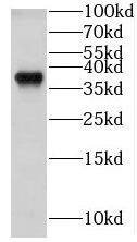 Western Blot: GNB1 Antibody - BSA Free [NBP3-46209] - Jurkat cells were subjected to SDS PAGE followed by western blot with (GNB1 antibody) at dilution of 1:2000