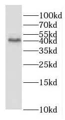 Western Blot GNA14 Antibody - BSA Free