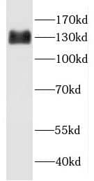 Western Blot: GEM Interacting Protein Antibody - BSA Free [NBP3-46213] - Jurkat cells were subjected to SDS PAGE followed by western blot with ( GEM Interacting Protein Antibody) at dilution of 1:600