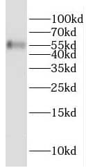 Western Blot GMCL1 Antibody - BSA Free