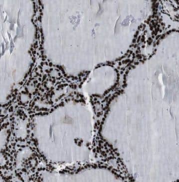 Immunohistochemistry GMCL1 Antibody - BSA Free