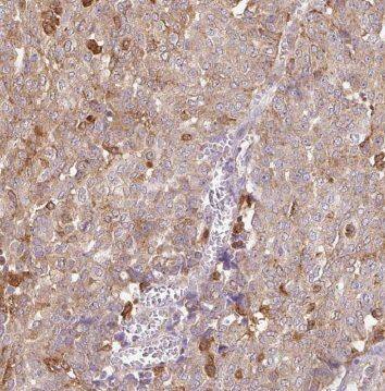 Immunohistochemistry GLYATL1 Antibody - BSA Free