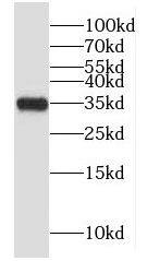 Western Blot GLYATL1 Antibody - BSA Free