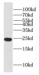 Western Blot: GLTP Antibody - BSA Free [NBP3-46218] - Mouse brain tissue were subjected to SDS PAGE followed by western blot with (GLTP antibody) at dilution of 1:1000