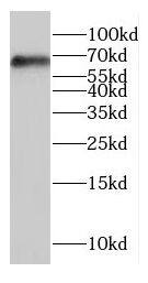 Western Blot: GLT25D2 Antibody - BSA Free [NBP3-46219] - SH-SY5Y cells were subjected to SDS PAGE followed by western blot with ( GLT25D2 Antibody) at dilution of 1:600
