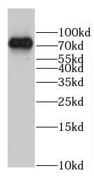Western Blot: GLT25D1 Antibody - BSA Free [NBP3-46220] - HeLa cells were subjected to SDS PAGE followed by western blot with ( GLT25D1 Antibody) at dilution of 1:1000