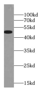 Western Blot Glycine Receptor alpha 2 Antibody - BSA Free