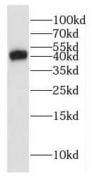 Western Blot: GLI4 Antibody - BSA Free [NBP3-46224] - Jurkat cells were subjected to SDS PAGE followed by western blot with (GLI4 antibody) at dilution of 1:600