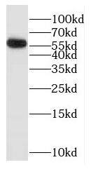Western Blot: GK5 Antibody - BSA Free [NBP3-46226] - Jurkat cells were subjected to SDS PAGE followed by western blot with (GK5 antibody) at dilution of 1:500