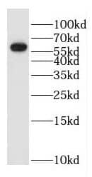 Western Blot GK3P Antibody - BSA Free
