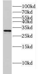 Western Blot: Connexin 31/GJB3 Antibody - BSA Free [NBP3-46230] - Mouse ovary tissue were subjected to SDS PAGE followed by western blot with (Connexin 31/GJB3 antibody) at dilution of 1:1000
