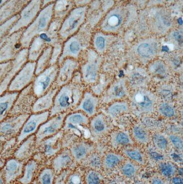 Immunohistochemistry Connexin 31/GJB3 Antibody - BSA Free