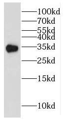 Western Blot: GIPC2 Antibody - BSA Free [NBP3-46232] - HEK-293 cells were subjected to SDS PAGE followed by western blot with (GIPC2 antibody) at dilution of 1:2500