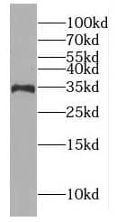 Western Blot: GIMAP7 Antibody - BSA Free [NBP3-46233] - Jurkat cells were subjected to SDS PAGE followed by western blot with (GIMAP7 antibody) at dilution of 1:800