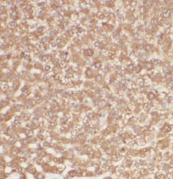 Immunohistochemistry: GGCX Antibody - BSA Free [NBP3-46236] - Immunohistochemistry of paraffin-embedded human liver using (GGCX antibody) at dilution of 1:100