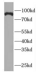 Western Blot: GGCX Antibody - BSA Free [NBP3-46236] - MCF7 cells were subjected to SDS PAGE followed by western blot with (GGCX antibody) at dilution of 1:2000